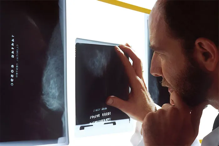 "How Did They Make This Far?": 40 Medical Professionals Remember The Most Notorious Darwin Award Candidates They've Ever Met