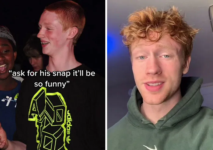 People Who Were Picked On And Bullied For Their Looks Reveal Their Jaw-Dropping Transformations