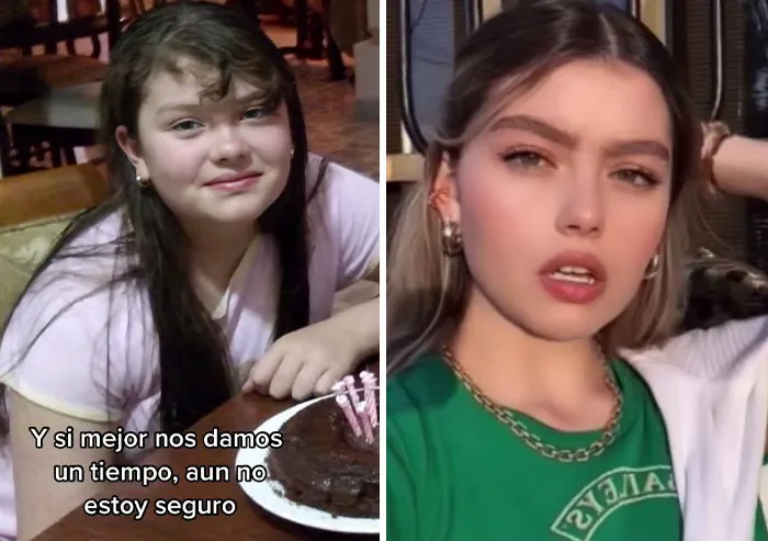 People Who Were Picked On And Bullied For Their Looks Reveal Their Jaw-Dropping Transformations