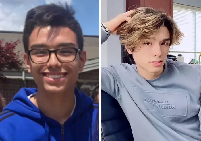 People Who Were Picked On And Bullied For Their Looks Reveal Their Jaw-Dropping Transformations