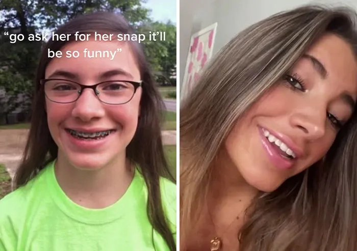 People Who Were Picked On And Bullied For Their Looks Reveal Their Jaw-Dropping Transformations