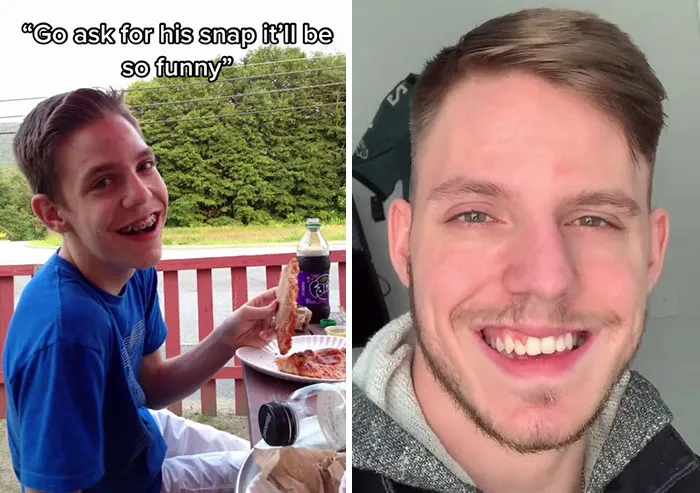 People Who Were Picked On And Bullied For Their Looks Reveal Their Jaw-Dropping Transformations