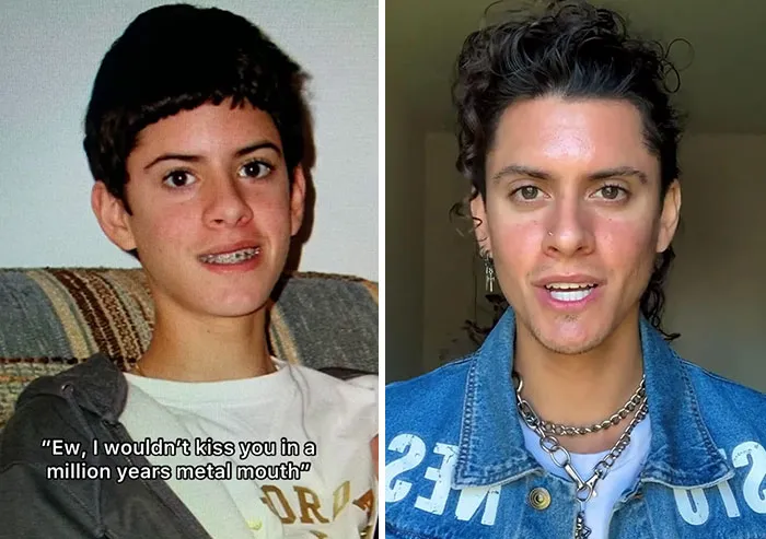 People Who Were Picked On And Bullied For Their Looks Reveal Their Jaw-Dropping Transformations