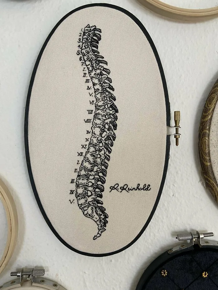 Spine Pt. 1 Of 2