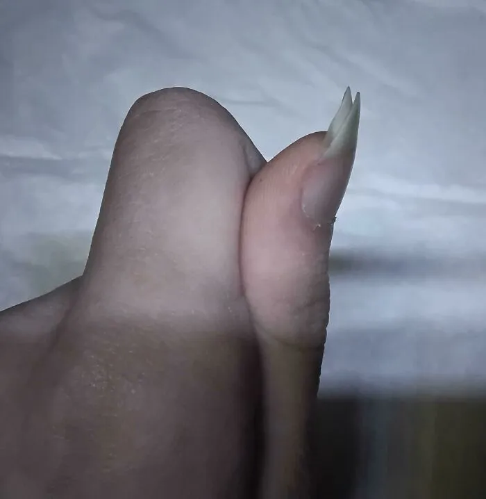 Double Thumb Nails!