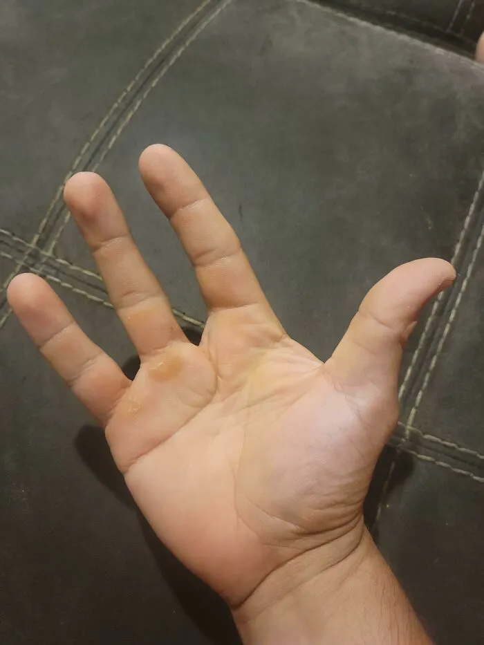 My Hand After A Shower