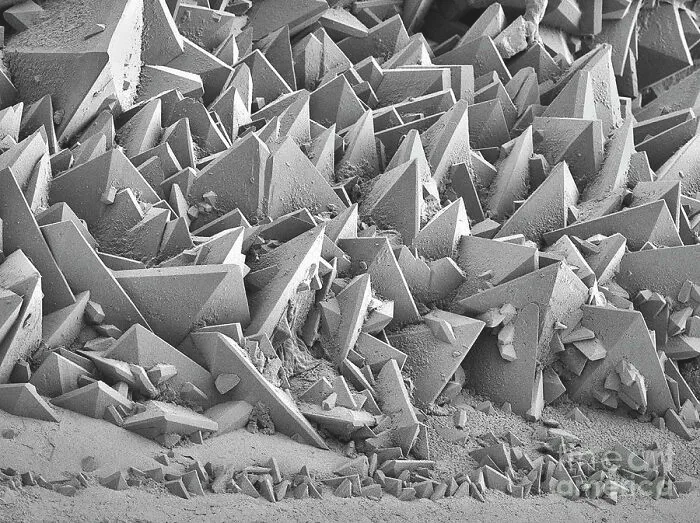 La superficie de una piedra en el riñón bajo un microscopio de electrones