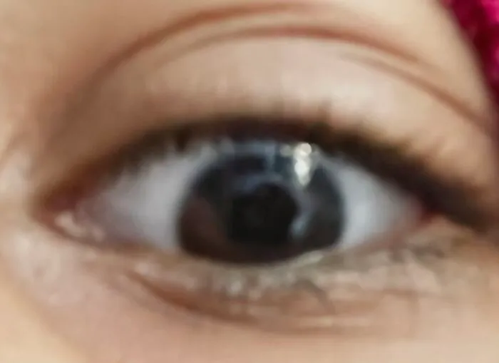 My Ugly Ass Eye 💀