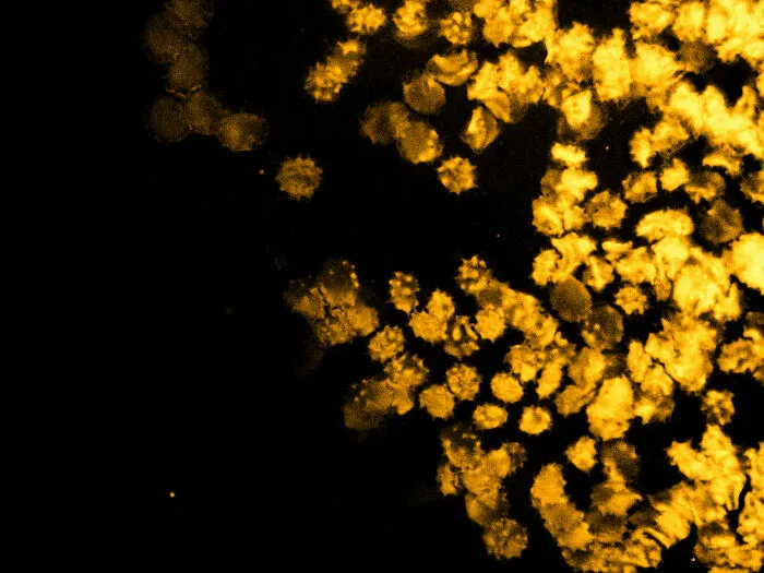 Blood Cells & Platelets II