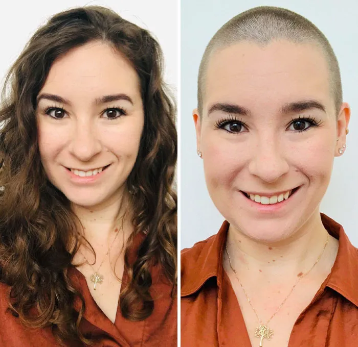 I Shaved My Head And Raised $1300 For Charity. Looking Forward To Experimenting With Styles As It Grows Out