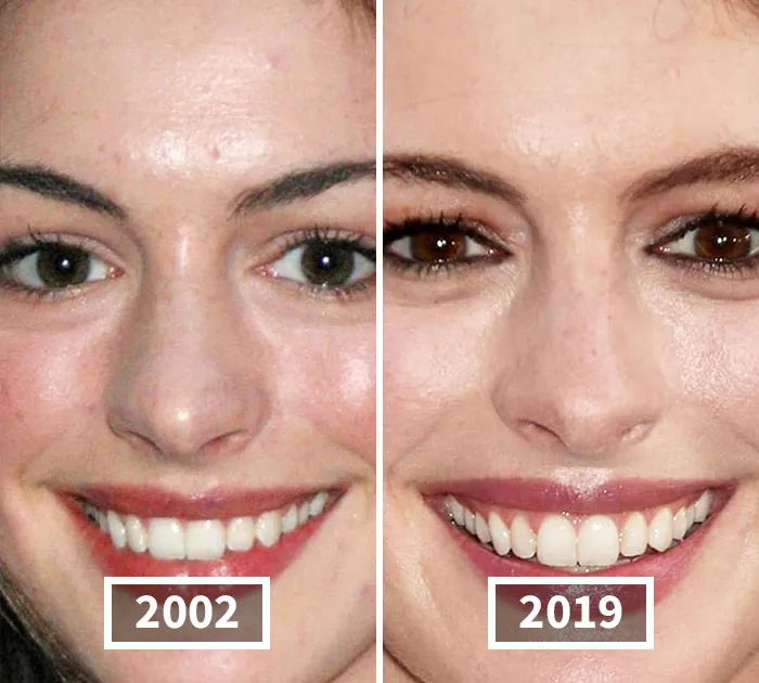 Anne Hathaway
