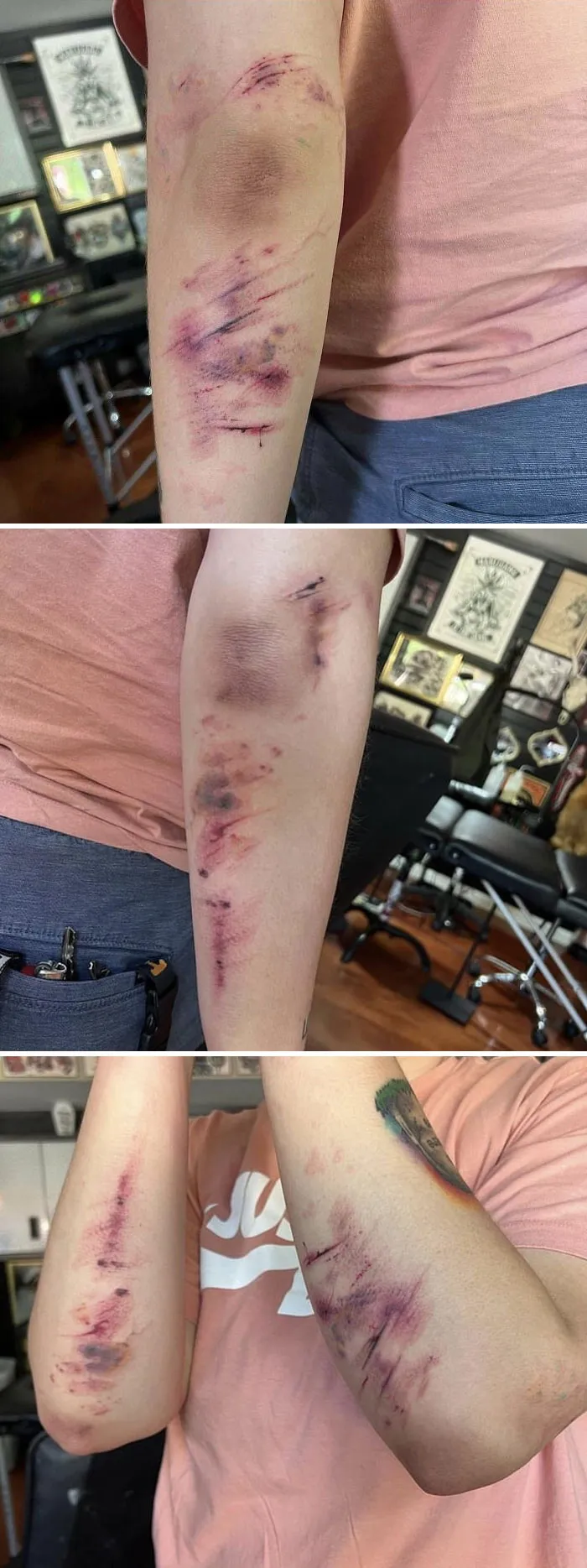 Pretty Sure These Bruise Tattoos Belong Here