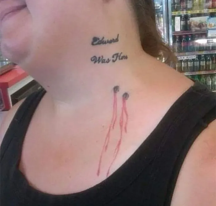 Skin Of A Killer