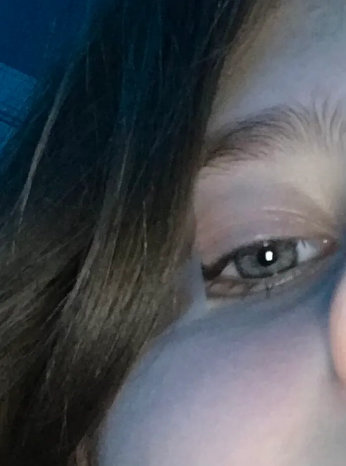 Tape Courtesy Of My Friend Who Thought My Face Was Perfect For Tape Placement