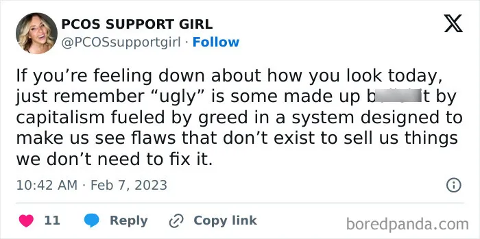 As A Pcos Patient Who Often Feels Bad About How She Looks, I Need This Reminder A Lot