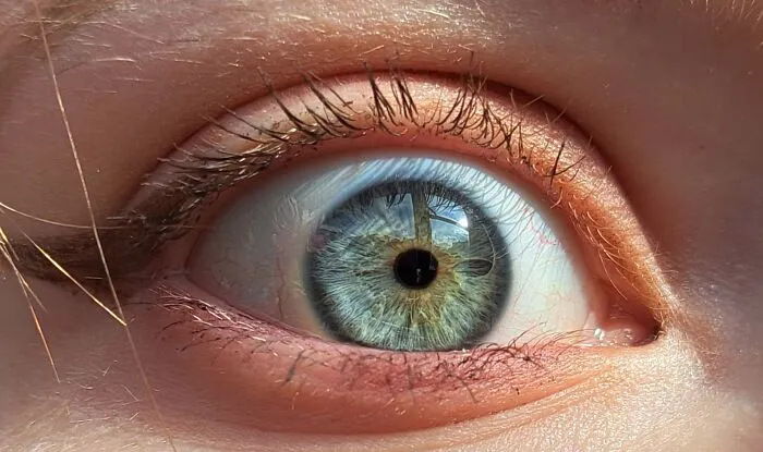 My Eye In The Sun!