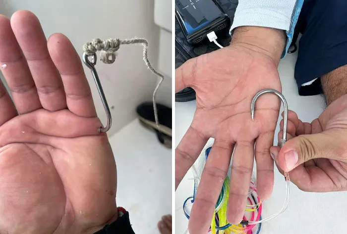 When Fishing Goes Wrong