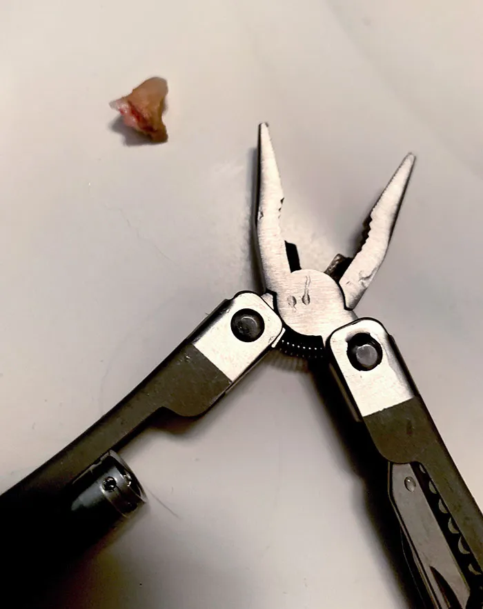 Today, I Pulled My Own Tooth Out With These Dollar Store Pliers
