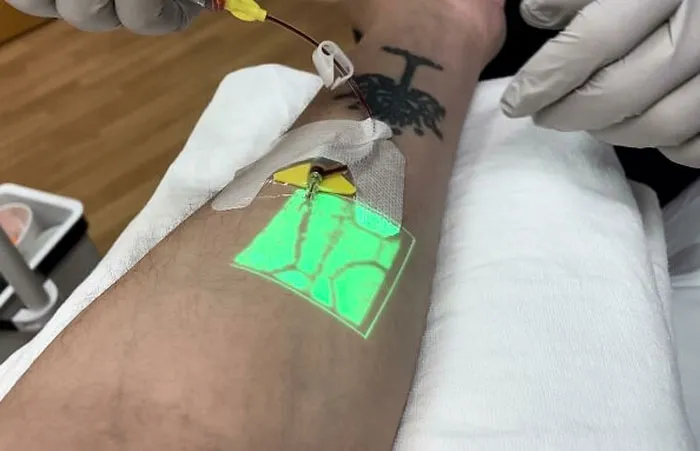 Today The Nurse Used An Infrared Vein Finder To Place An IV