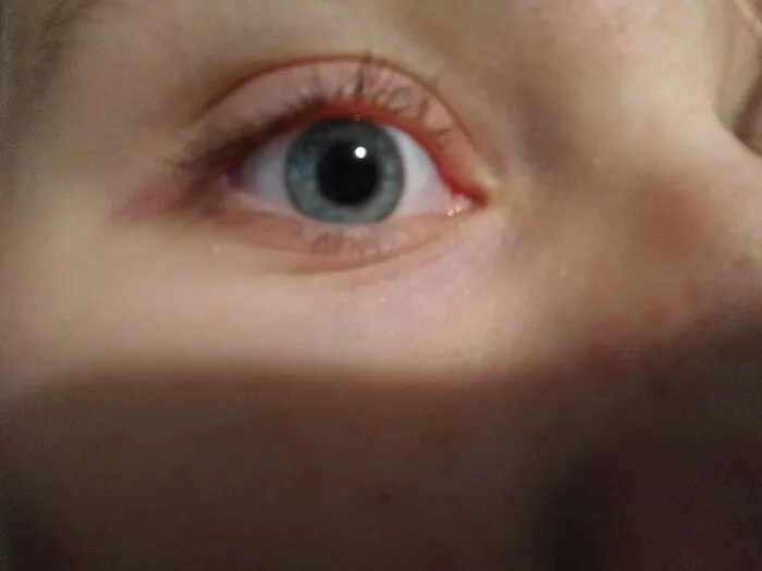 My Camera Is Not Very Good, I Might Post A Second Picture Where You Can See The Blue Part Better