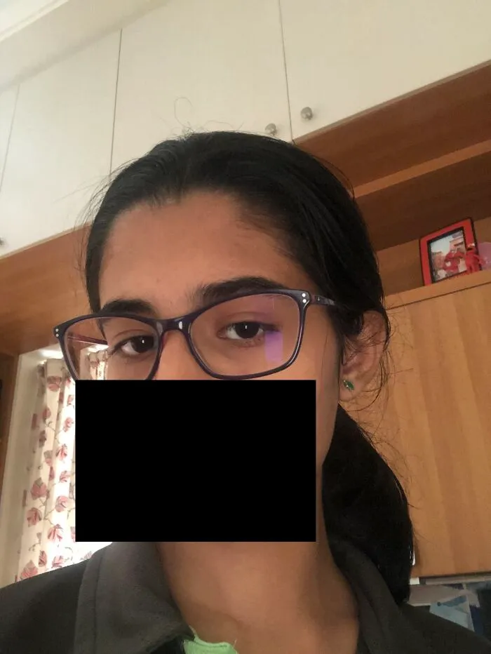 Moi