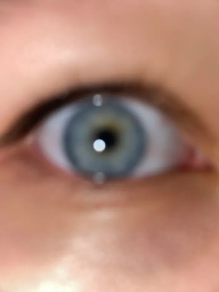 E Y E B A L L