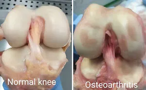 40 Bizarre And Inspiring Medical Cases That People Shared On This Online Community (New Pics)