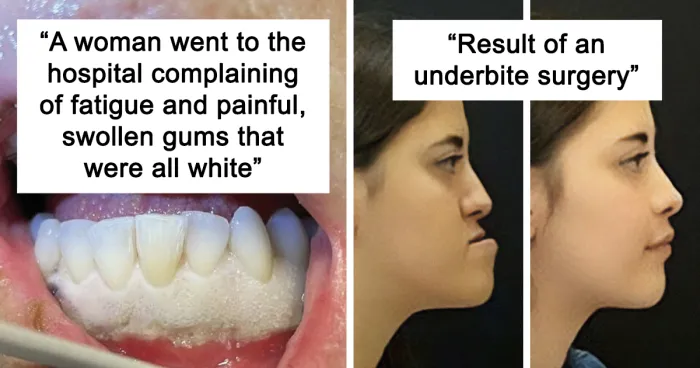 40 Bizarre And Inspiring Medical Cases That People Shared On This Online Community (New Pics)