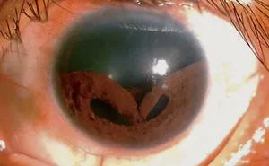 40 Bizarre And Inspiring Medical Cases That People Shared On This Online Community (New Pics)