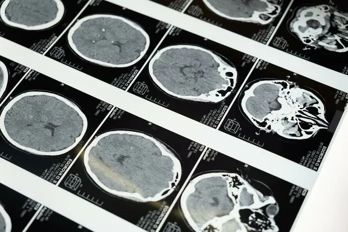 "¿Qué pasó con la persona más inteligente de tu escuela?": 20 respuestas
