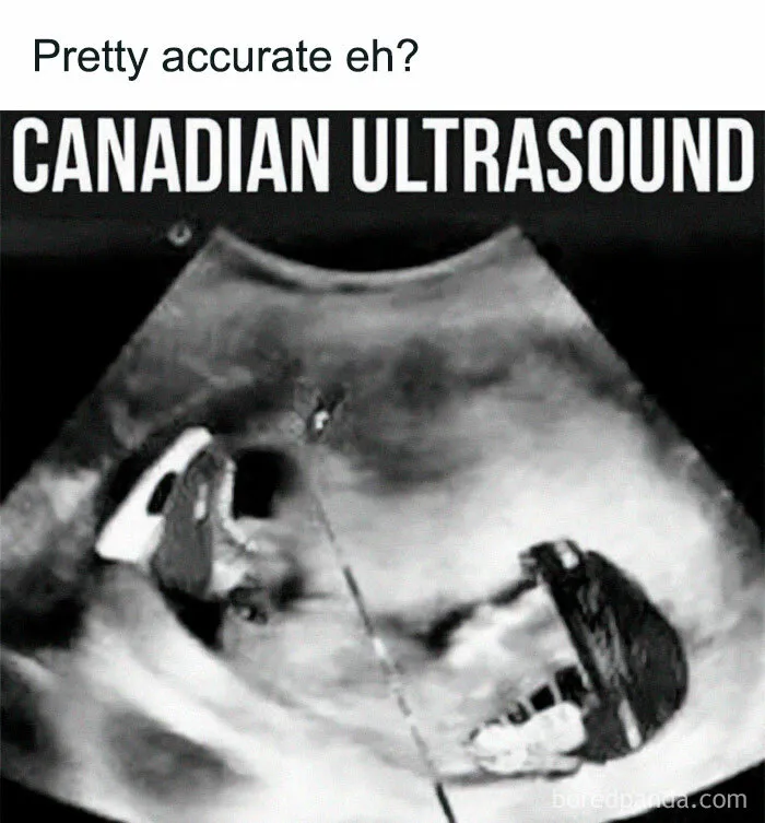 “Only In Canada”: 30 Memes And Posts That Perfectly Describe The Country