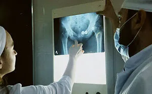 “What Is The Stupidest Reason You Went To Hospital?” (35 Answers)