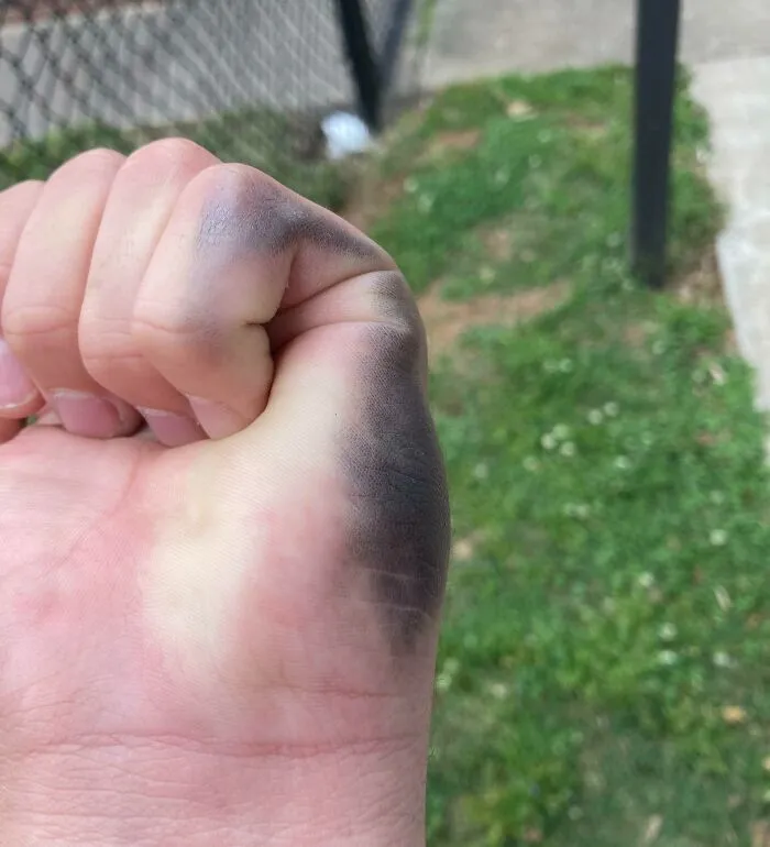 Left-Handed People Know The Pain