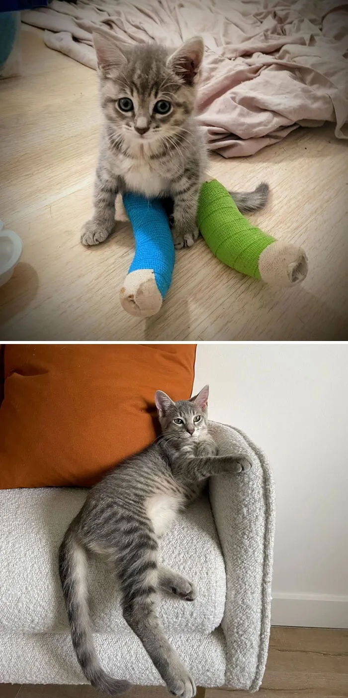 From Broken Legs To Long Legs