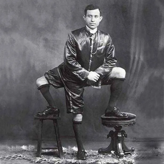 Francesco Lentini, italoamericano nacido con 3 piernas, 4 pies y 2 juegos de genitales funcionales. Pasó la vida trabajando en el circo y murió a los 77 años