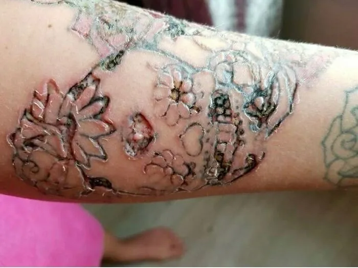 30 Personas que no se dan cuenta de lo horribles que son sus tatuajes (nuevas imágenes)