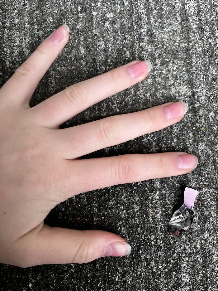 I Have Weird Nails