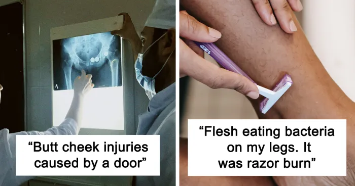 “What Is The Stupidest Reason You Went To Hospital?” (35 Answers)