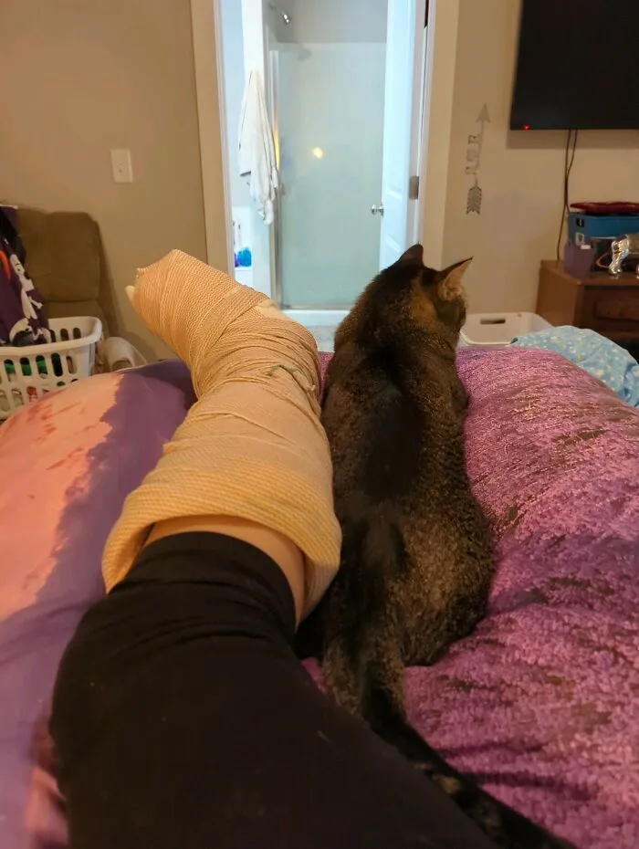 Big Boy--My Maine Coon Is As Big As My Splint