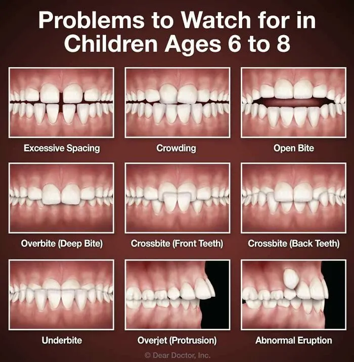 A Cool Guide On Common Type Of Bites Problems In Children