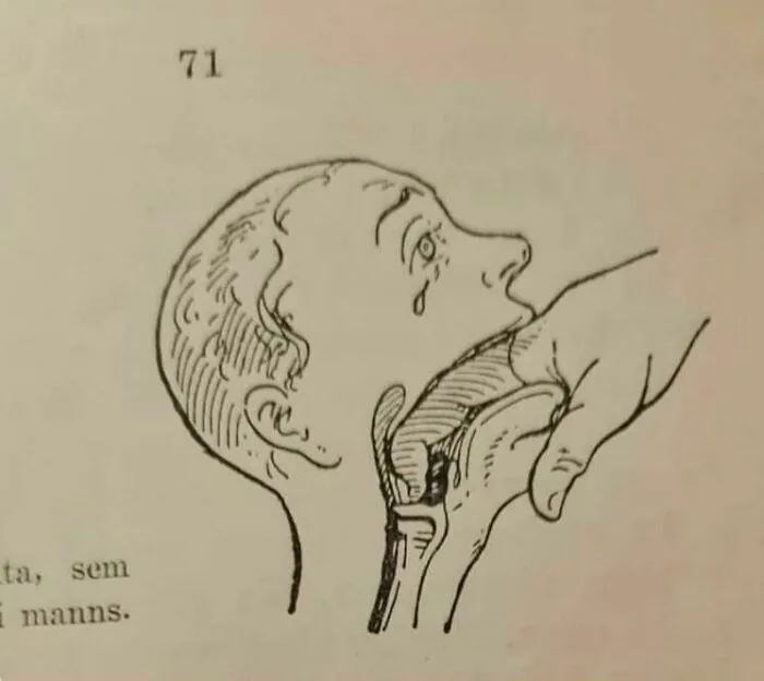 First Aid Manual Of What To Do When Someone Is Choking