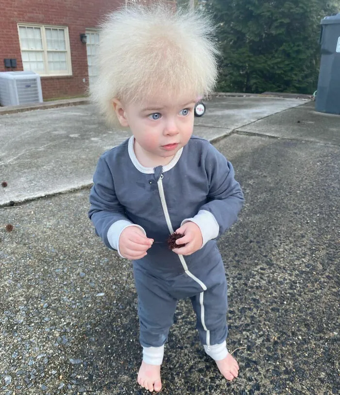 "Uncombable Hair Syndrome" Is A Rare And Harmless Condition That Disappears Around Puberty