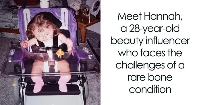 This Resilient Woman Became A Beauty Influencer Despite Her Disability