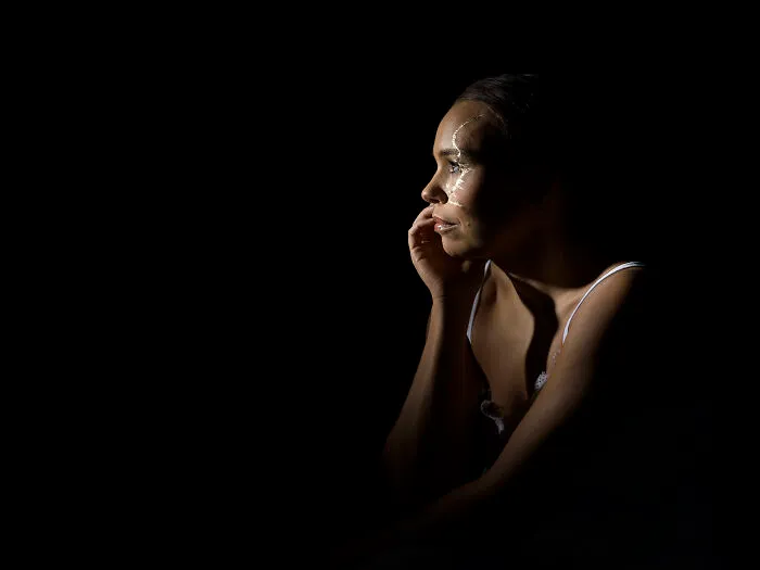 Kintsugi Beauty: Celebrating The Beauty Of Scars And Imperfections In Photography