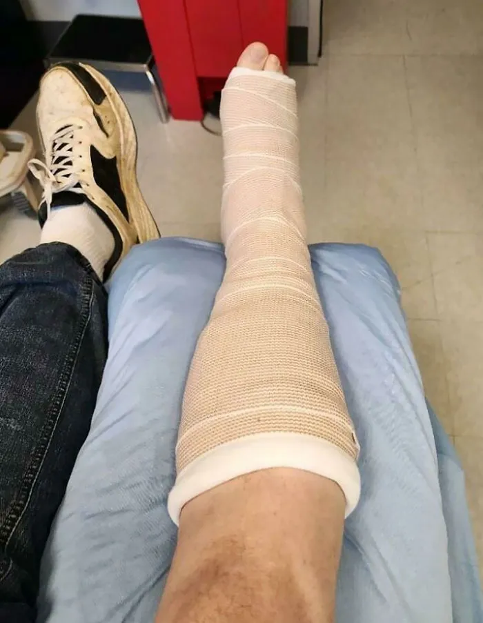 Hubby Was Unemployed For 9 Months. Finally Landed A Job That's Not Temporary Or A Contract Gig. 5 Minutes After Clocking In, He Trips On Some Carpet And Breaks His Leg