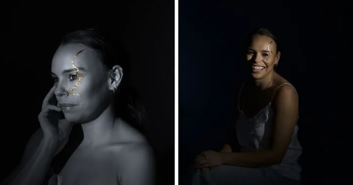 Kintsugi Beauty: Celebrating The Beauty Of Scars And Imperfections In Photography