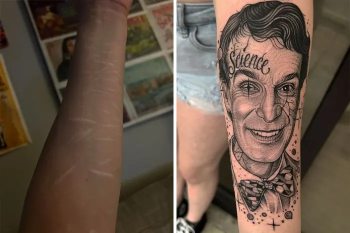 Look At This Scar Cover Up….bill Bill Bill!