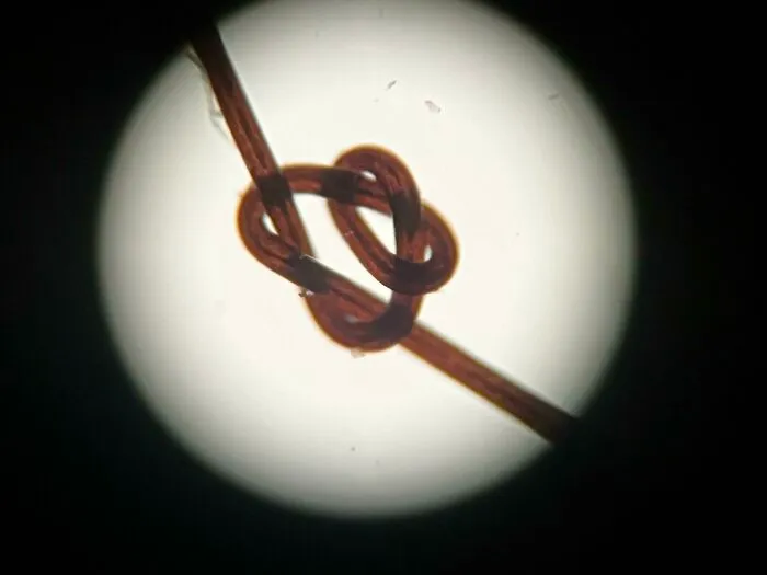 My Hair Had A Little Bump And I Looked At It Through A Microscope