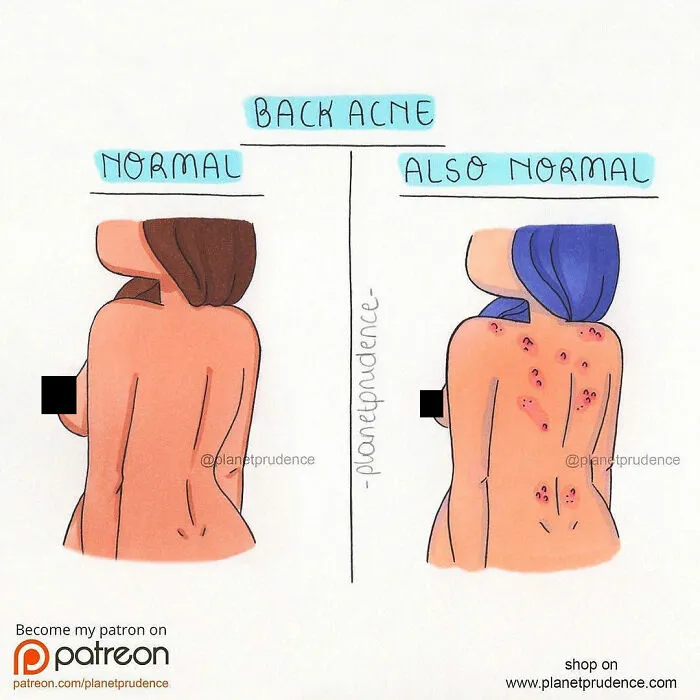 30 New Comics By "Planet Prudence" Showing What Being A Woman Is Like