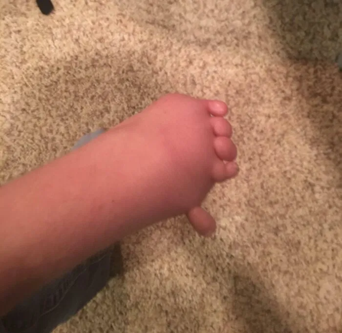 Nací con la mano izquierda así, puedo hacer muchas cosas